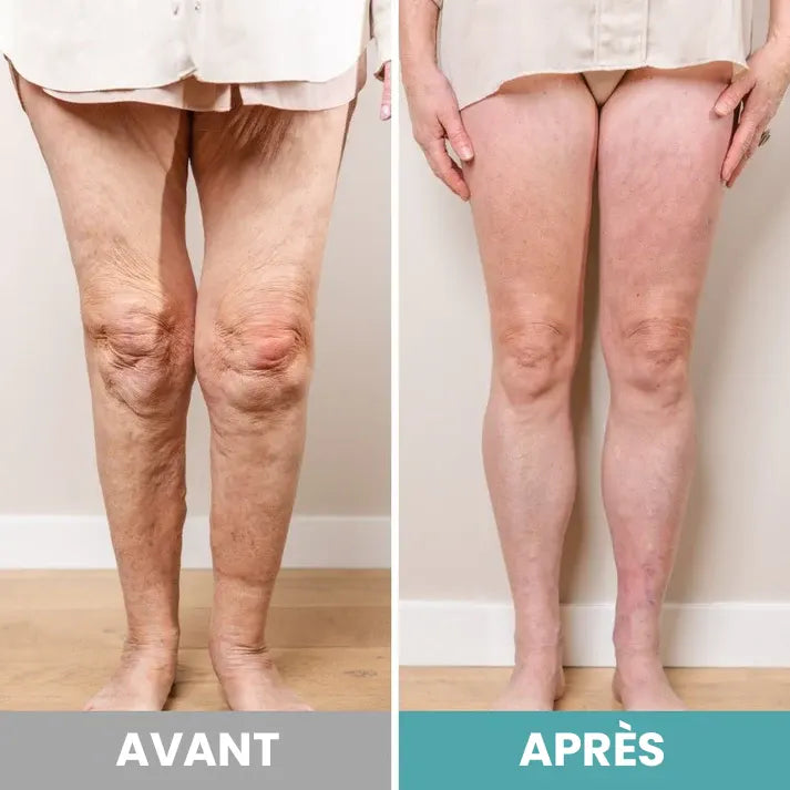 RelaxOn™ - Masseur de pieds